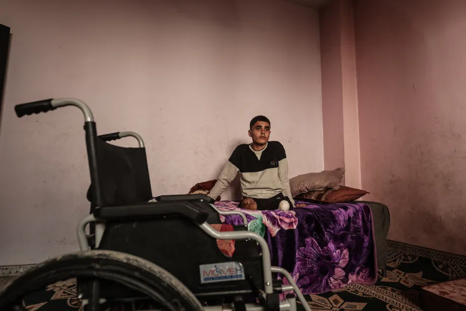 Gaza teen amputee bears scars of Israeli genocide as besieged enclave leads world in child amputations – Middle East Monitor