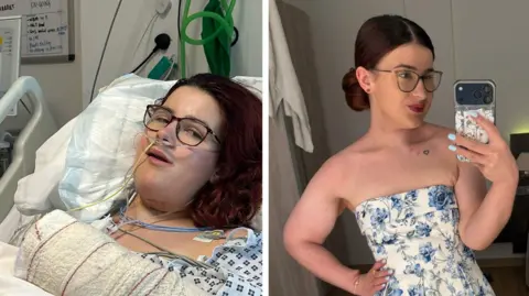 Harriet Trewhitt A side-by-side comparison showing Harriet during treatment and after.  On the left, Harriet is lying in a hospital bed with medical monitoring wires attached to her chest and a heavily bandaged arm resting on the bed. On the right, Harriet  is standing indoors, taking a mirror selfie with a smartphone, wearing a strapless white dress with blue floral patterns.