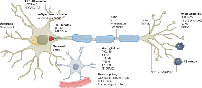 Biofluid biomarkers in Alzheimer’s disease and other neurodegenerative dementias