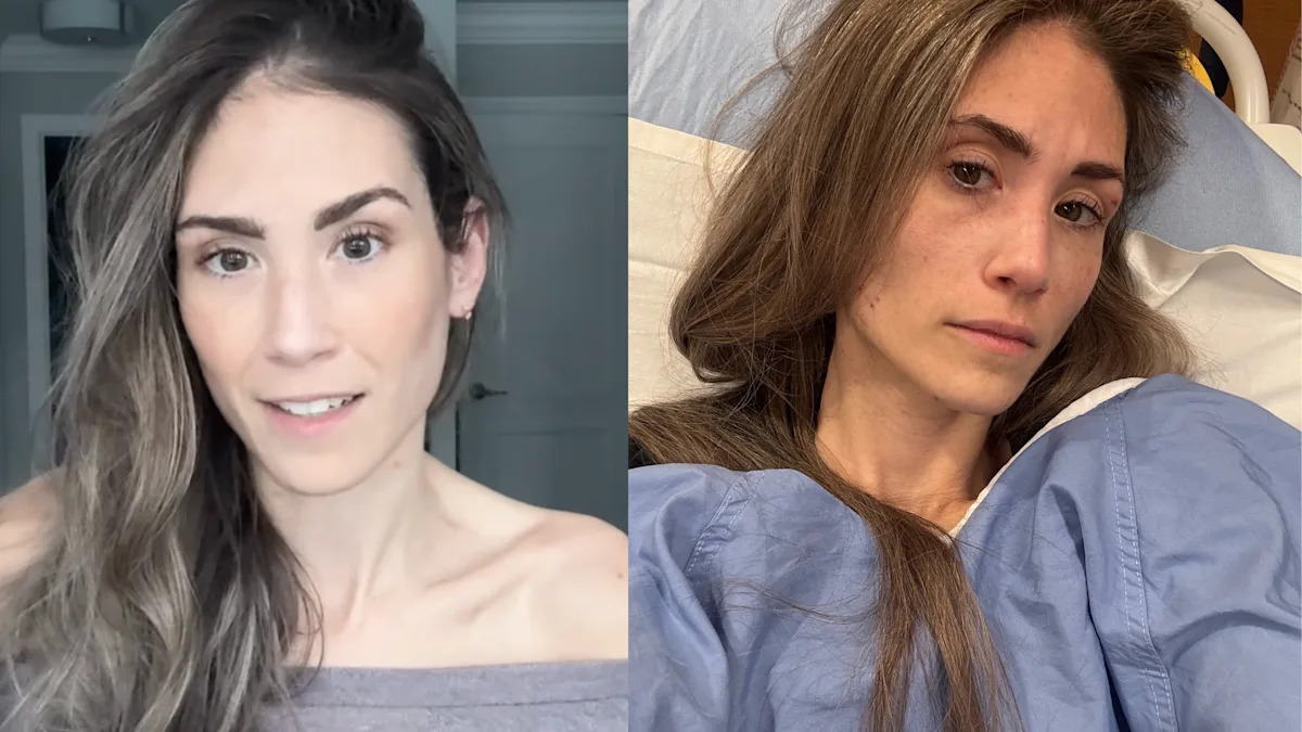 Toronto model Jess Grossman says an ER doctor ‘brushed off’ her pain. Then, she was diagnosed with rectal cancer