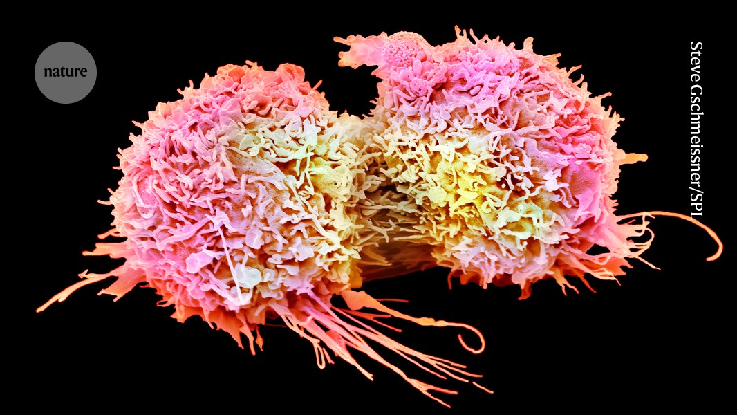 How tumours trick the brain into shutting down cancer-fighting cells