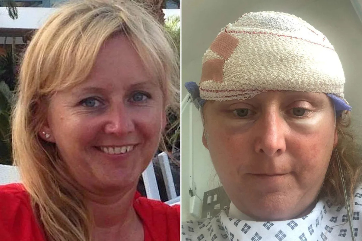 Mom, 54, ‘Terrified’ After Learning Her Menopause Hot Flashes Were Actually Seizures Caused by 10 Brain Tumors