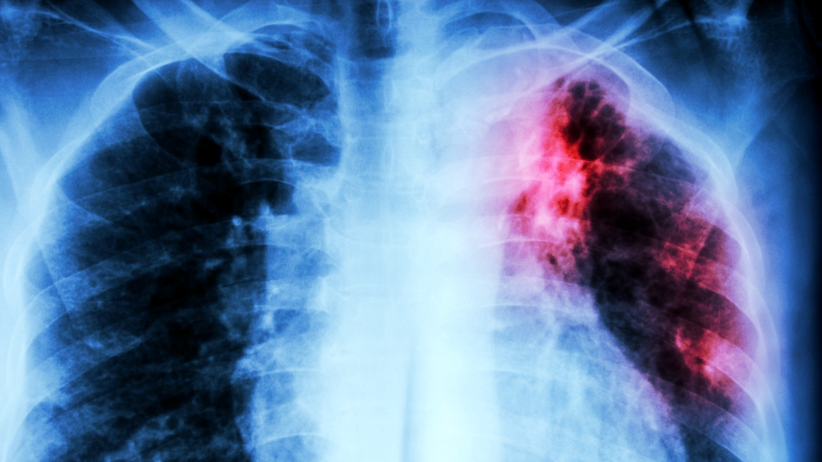 A New Clue Offers Hope Against The Deadliest Infection : ScienceAlert