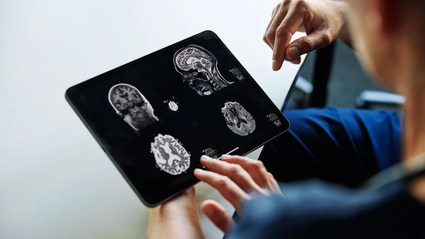 Can AI help doctors avoid missed diagnoses? A new study suggests yes