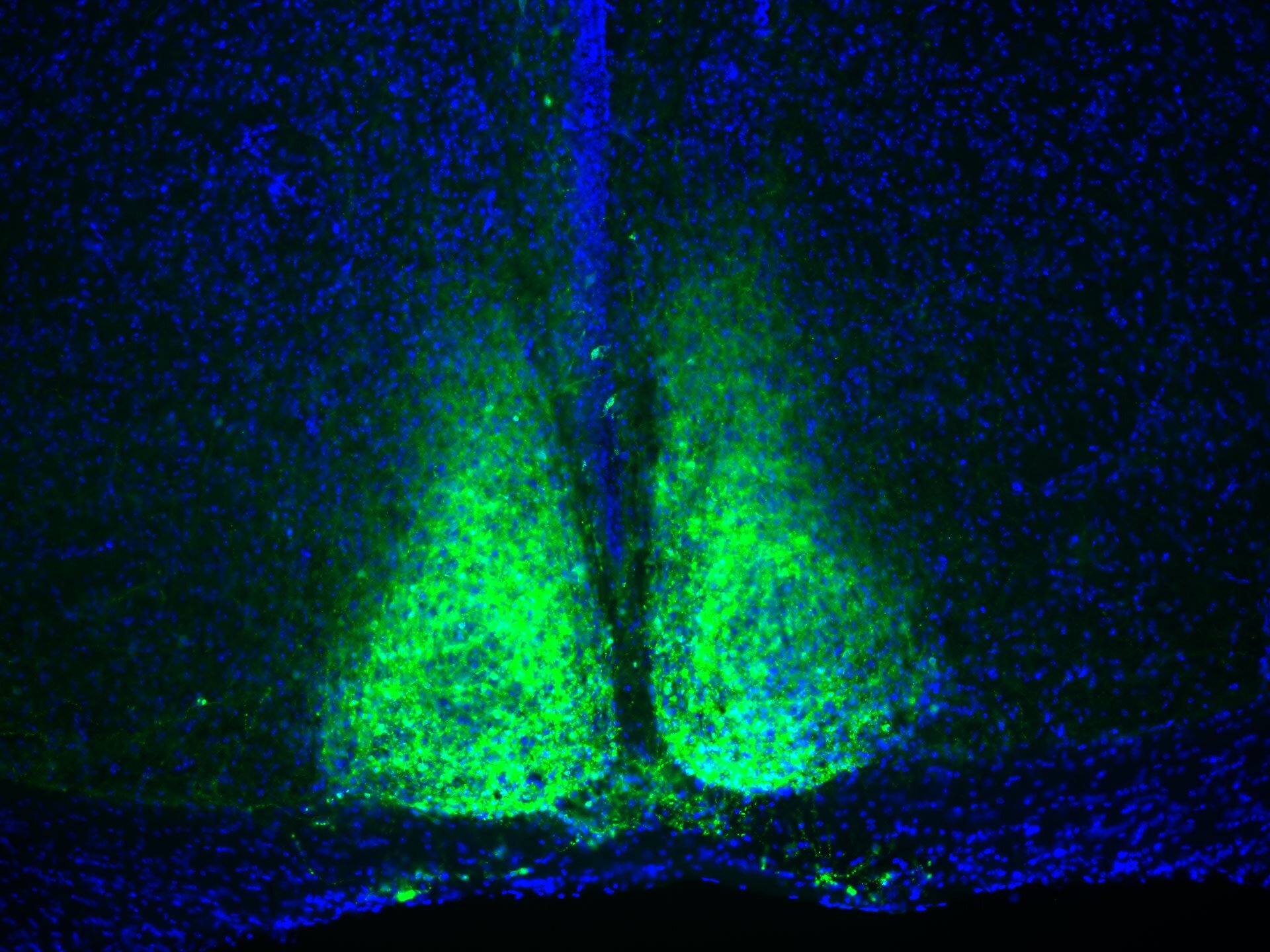 Brain circuit that times a state of low metabolism could have implications for space travel