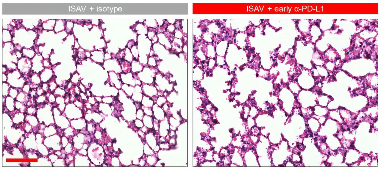 Early immunotherapy aids in treating potentially fatal fungal pneumonias in preclinical models