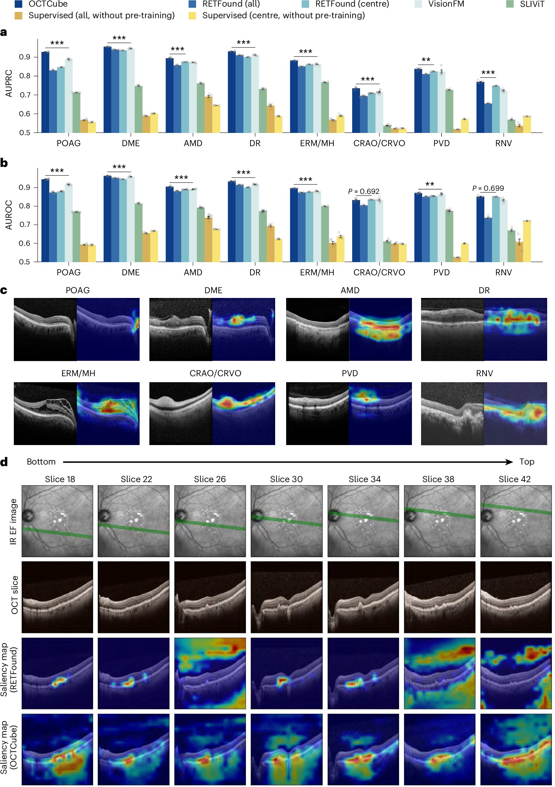 New AI tools could help eye doctors diagnose retinal disease faster