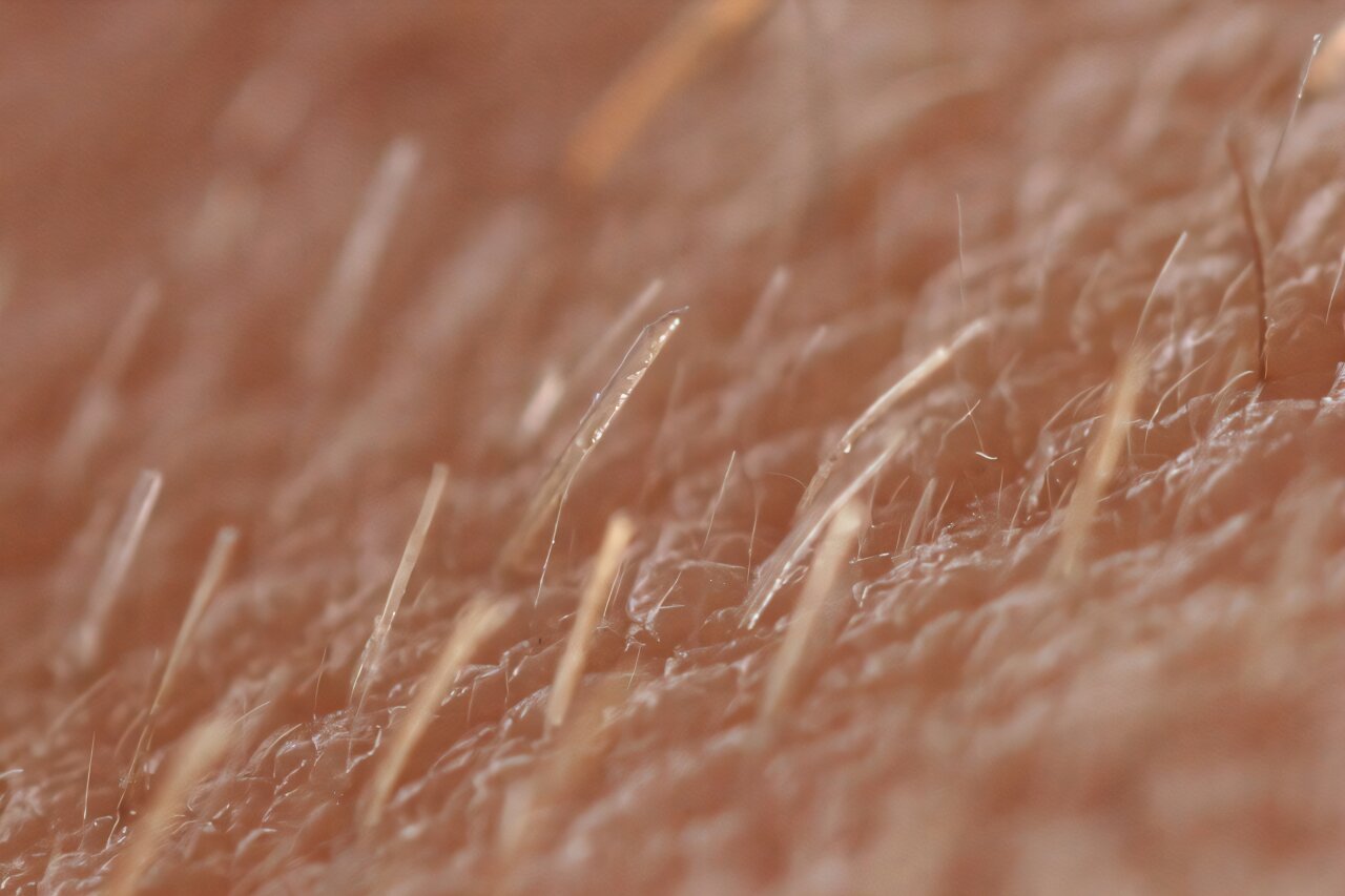 Peach fuzz may hold clues to new chronic itch treatments