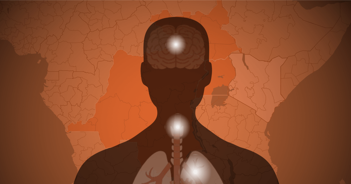 Tracking the 2026 Ebola outbreak in maps and figures: Locations, severity, how contagious it is and more