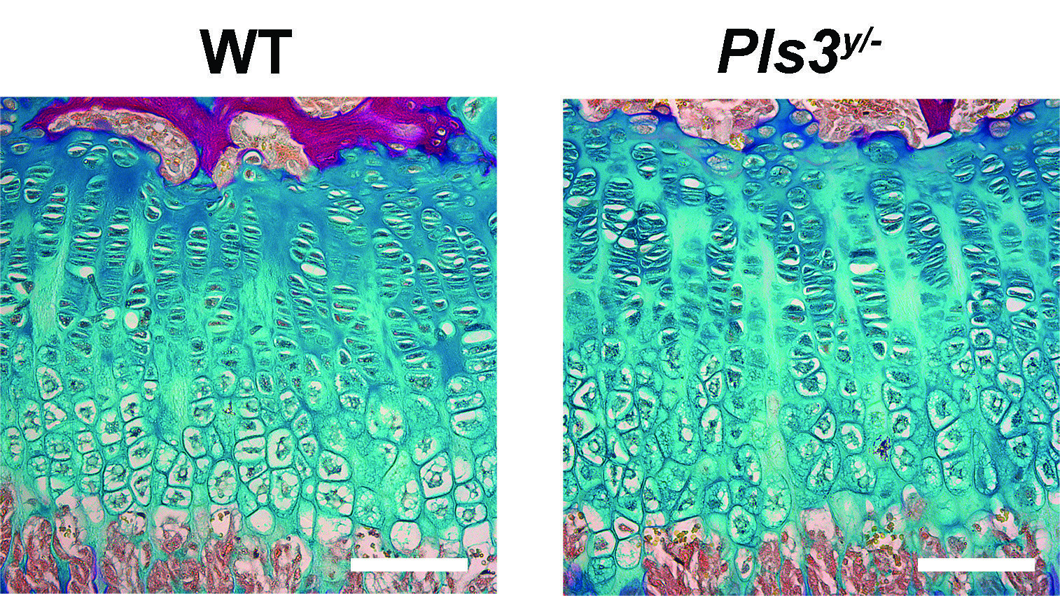 Genetic mapping identifies new hope for bone diseases