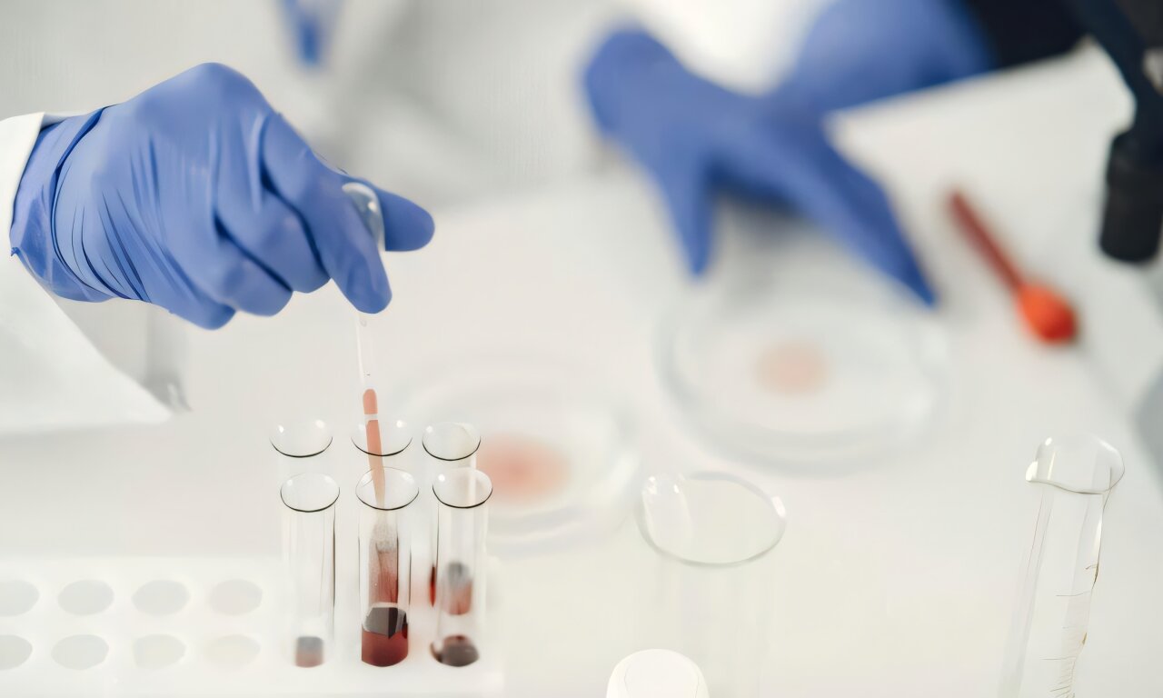 LIG1 loss exposes a therapeutic vulnerability in triple-negative breast cancer