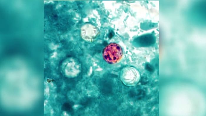 Precautions to take as cyclosporiasis cases in Michigan exceed 1,500